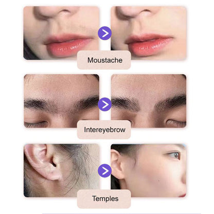 💗Last Day Special Price £9.99 ! 🔥Buy 2 Get 1 Free🔥Gentle and Painless Facial Hair Removal Cream
